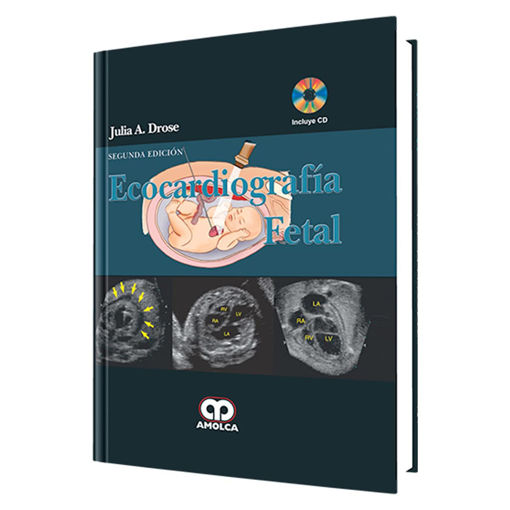 Imagen de Ecocardiografía fetal
