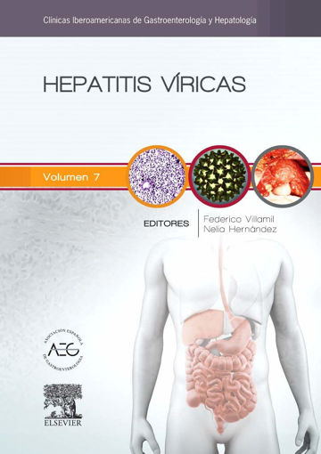 Imagen de Hepatitis víricas