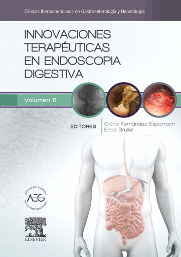 Imagen de Innovaciones terapéuticas en endoscopia digestiva