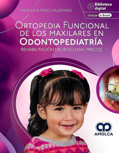 Imagen de Ortopedia funcional de los maxilares en odontopediatría Rehabilitación neuroclusal precoz