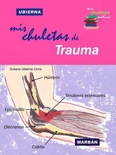 Imagen de Mis Chuletas de Trauma