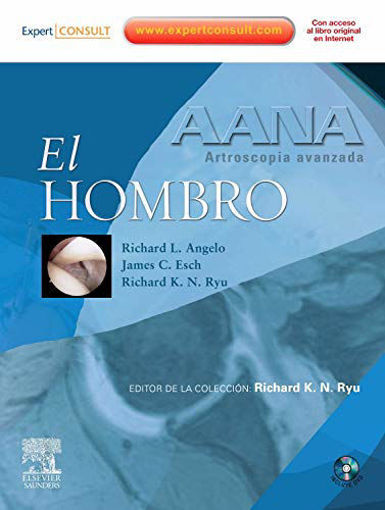 Imagen de AANA Artroscopía avanzada El hombro