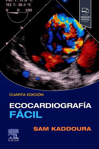 Imagen de Ecocardiografía fácil