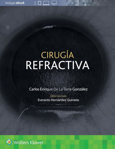 Imagen de Cirugía refractiva