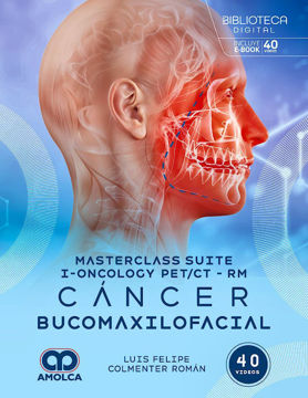 Imagen de Masterclass suite i-Oncology PET/CT-RM. Cáncer bucomaxilofacial