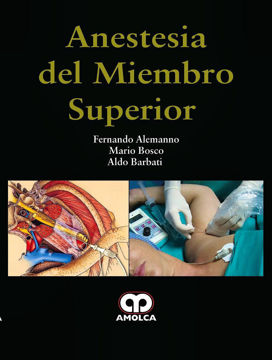 Imagen de Anestesia del Miembro Superior
