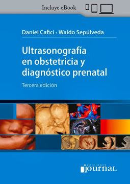 Imagen de Ultrasonografía en Obstetricia y Diagnóstico Prenatal  3ed
