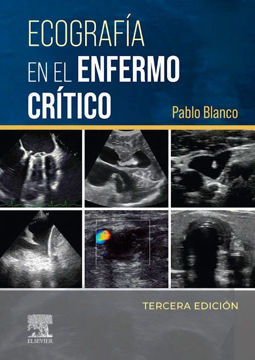 Imagen de Ecografía en el enfermo crítico