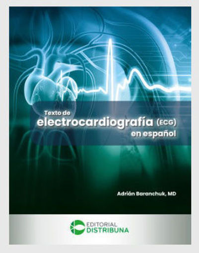 Imagen de Texto de electrocardiografía (ECG) en español