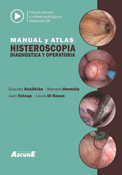 Imagen de MANUAL Y ATLAS  HISTEROSCOPIA DIAGNÓSTICA Y OPERATORIA - INCLUYE ACCESO A VIDEOS QUIRURGICOS