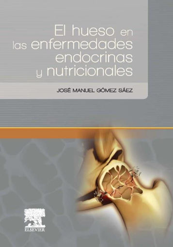 Imagen de EL HUESO EN LAS ENFERMEDADES ENDOCRINAS Y NUTRICIONALES