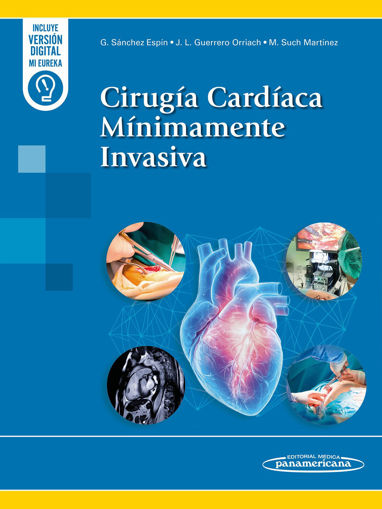Imagen de Cirugía Cardiaca Mínimamente Invasiva