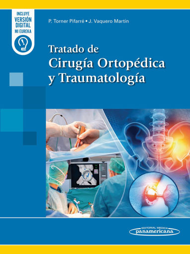 Imagen de Tratado de Cirugía Ortopédica y Traumatología