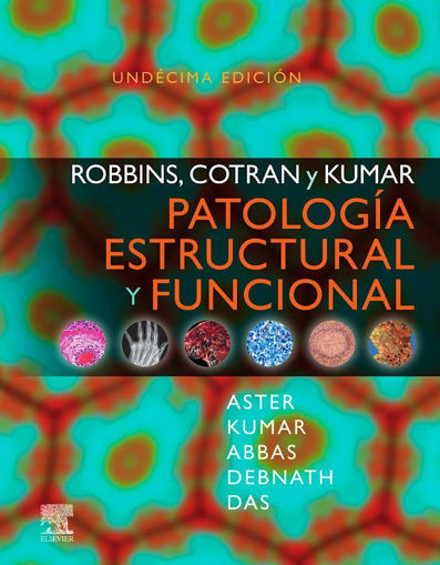 Imagen de Robbins, Cotran y Kumar. Patología estructural y funcional